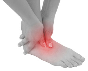  Ankle Sprain 