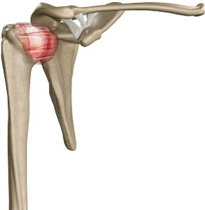 Shoulder Impingement