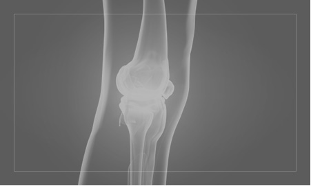 Spartan Orthopedic Institute